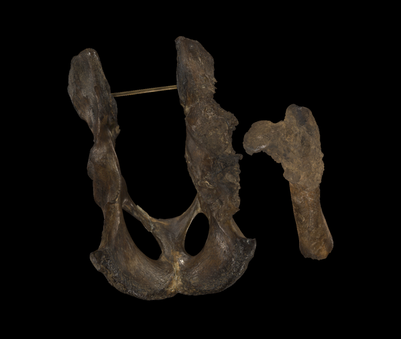 three-dimensional scan of the pathological pelvis and femur