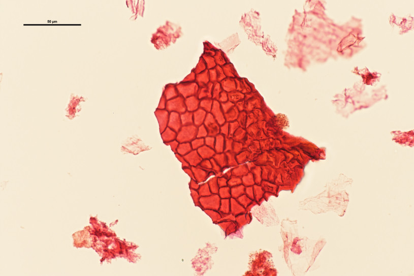 Red blobby shape broken up by irregular cell lines