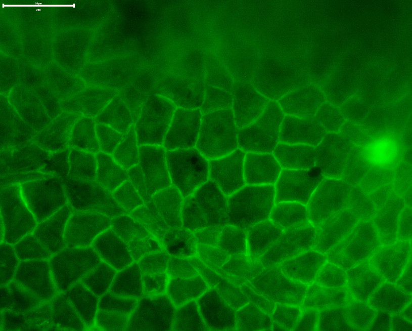 Flourescent green outlines cells of darker green